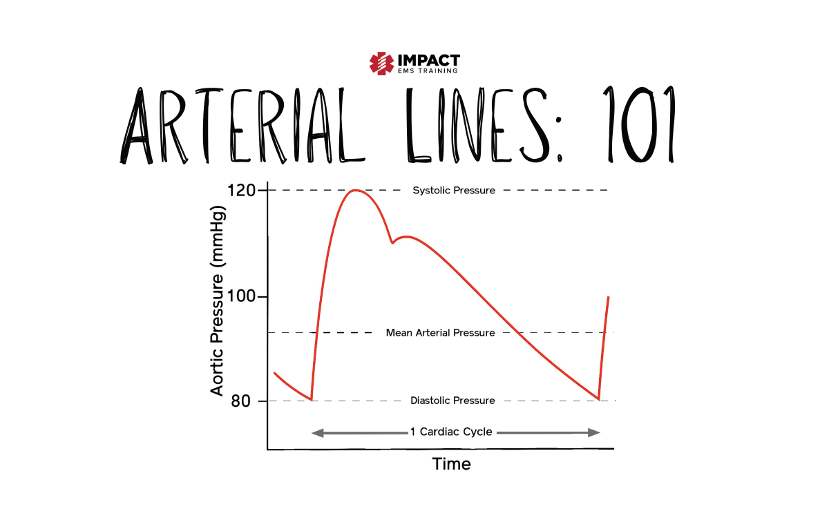 Arterial Lines 101 Impact EMS