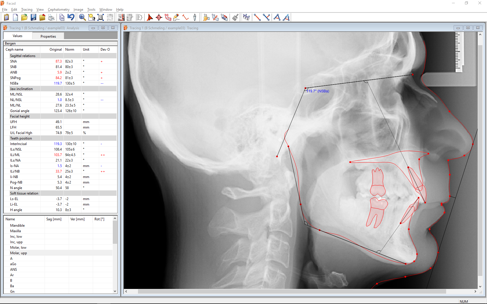 Facad Facad Ortho Tracing Software