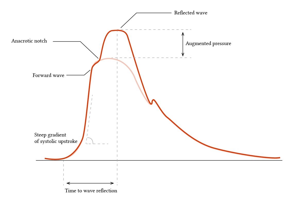 Interpretation Of Abnormal Arterial Line Waveforms Deranged 