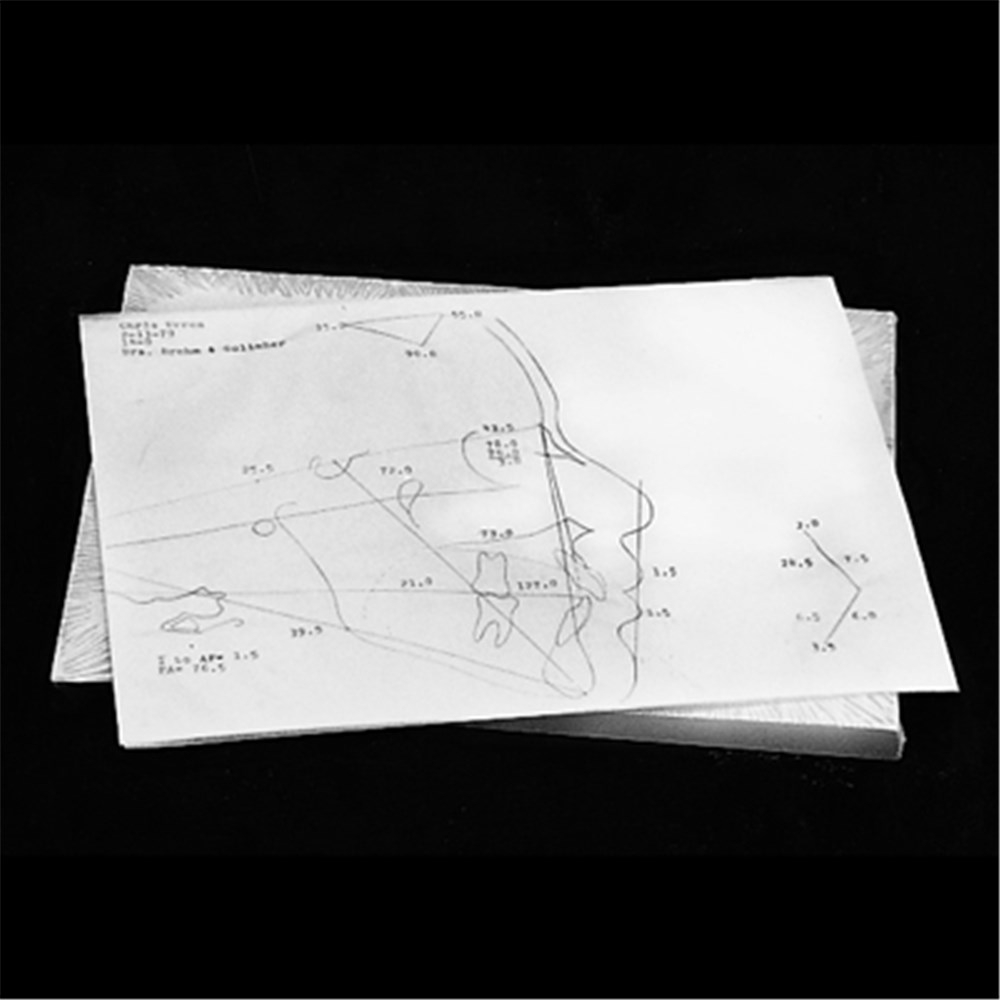 NAOL Ceph Tracing Paper 100 Pack Fixed Appliance Accessories 