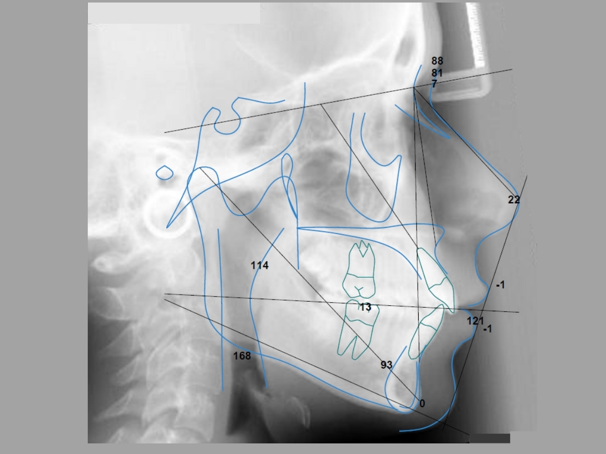 ORCA DENTAL AI SERVICES CephX AI Driven Dental Services CephX