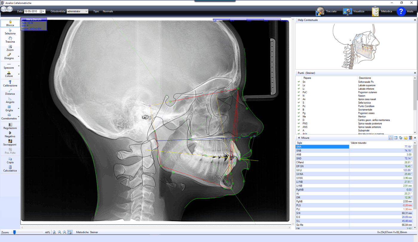 Free Cephalometric Tracing Software