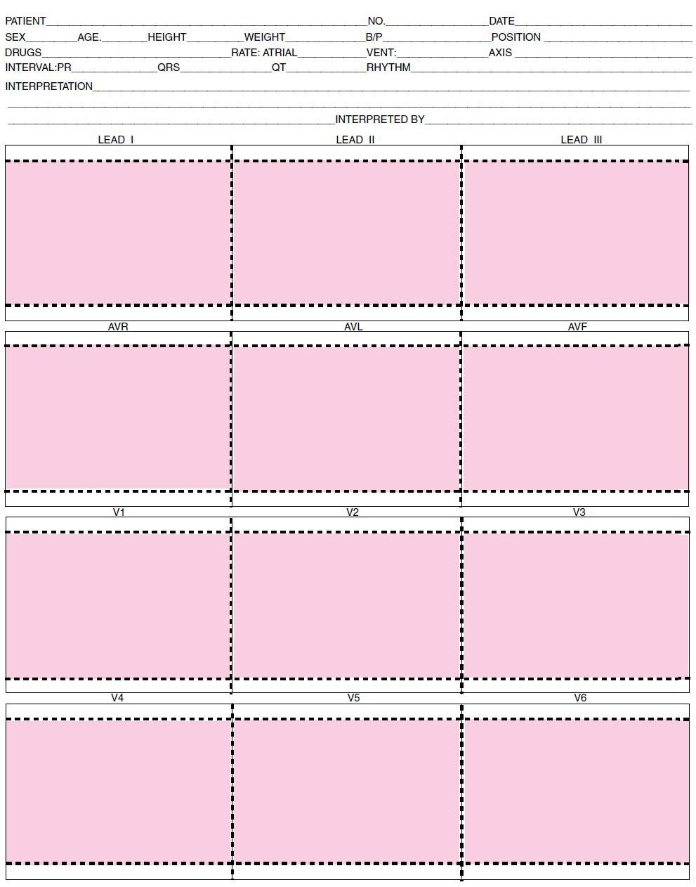 Quality Chart Paper ECG Mount For 12 lead Tracing 8 1 2 X 11 